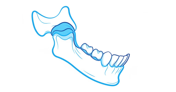 Relieve Jaw Pain with Expert Ottawa Jaw Therapy Solutions